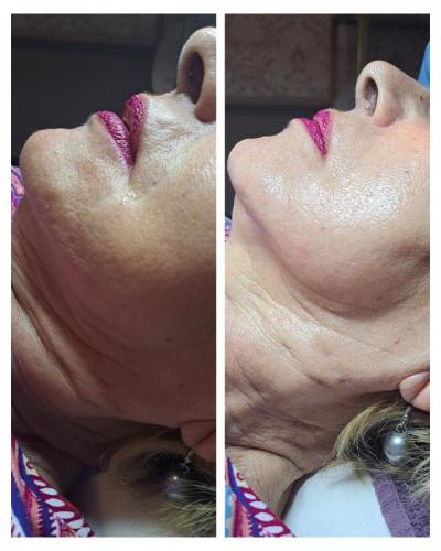 viber slika 2022-10-26 12-08-38-341